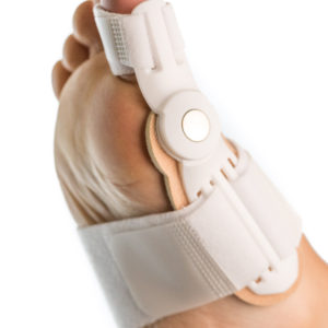 Bunion Devices